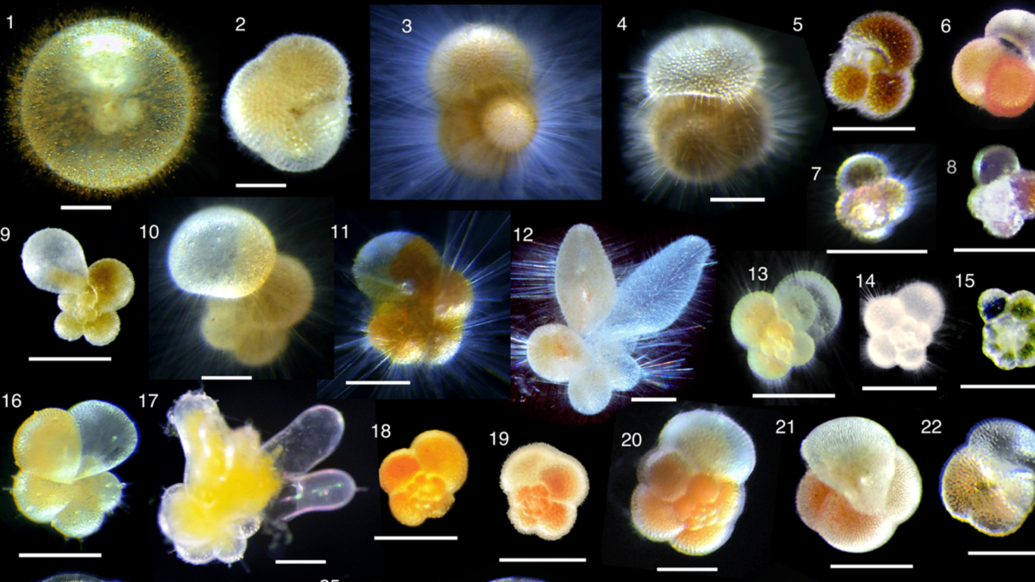 Magnification of many different foraminifera